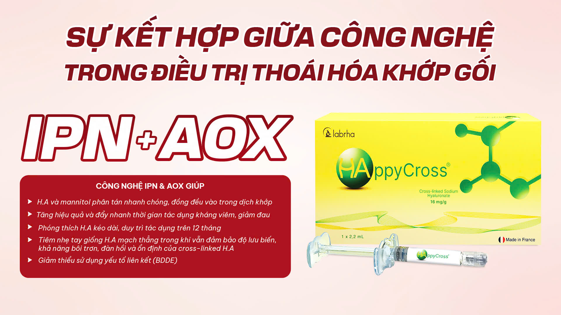 Sự kết hợp giữa công nghệ IPN và AOX trong điều trị thoái hóa khớp gối