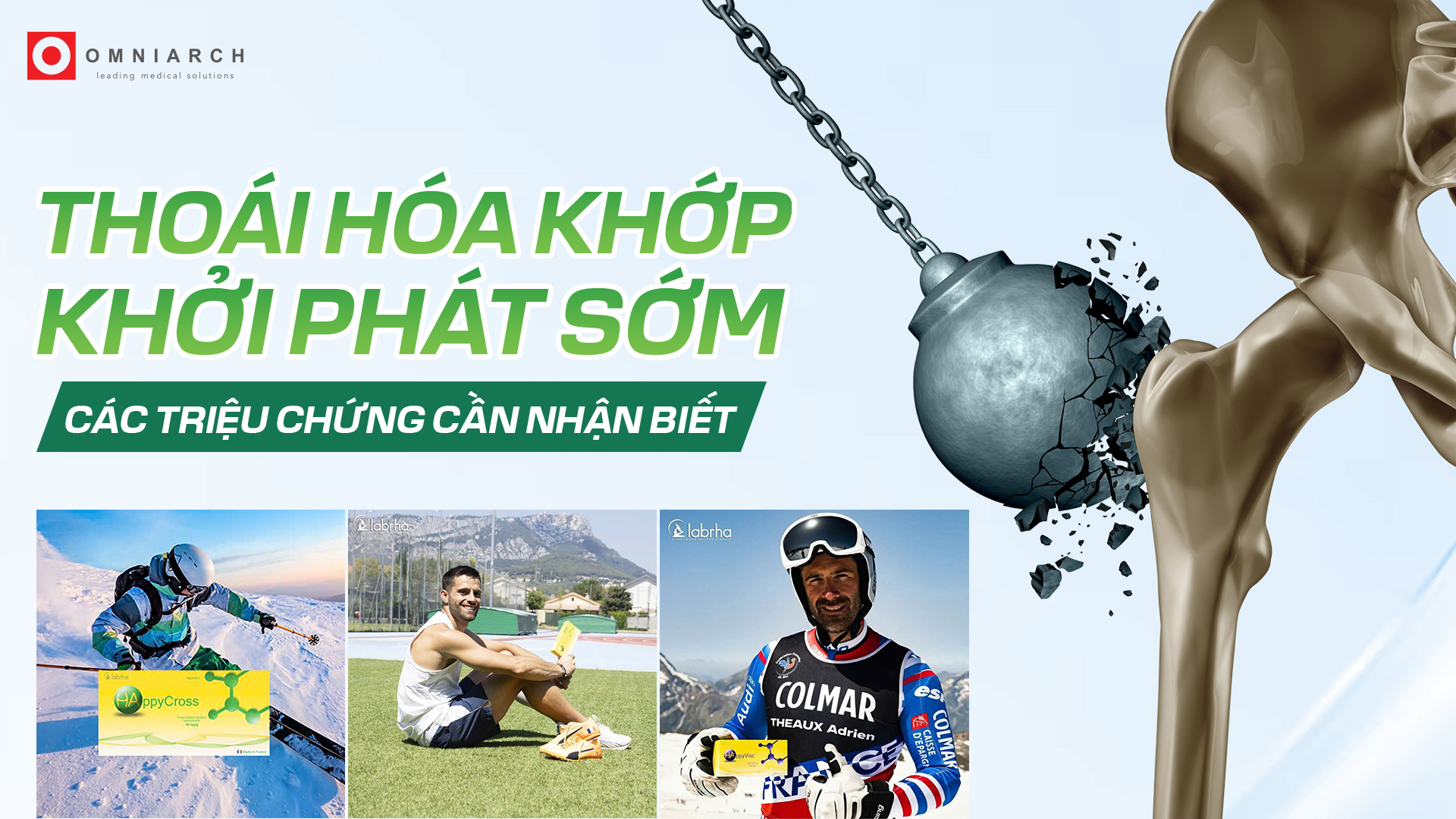 Thoái hóa khớp khởi phát sớm các triệu chứng cần nhận biết