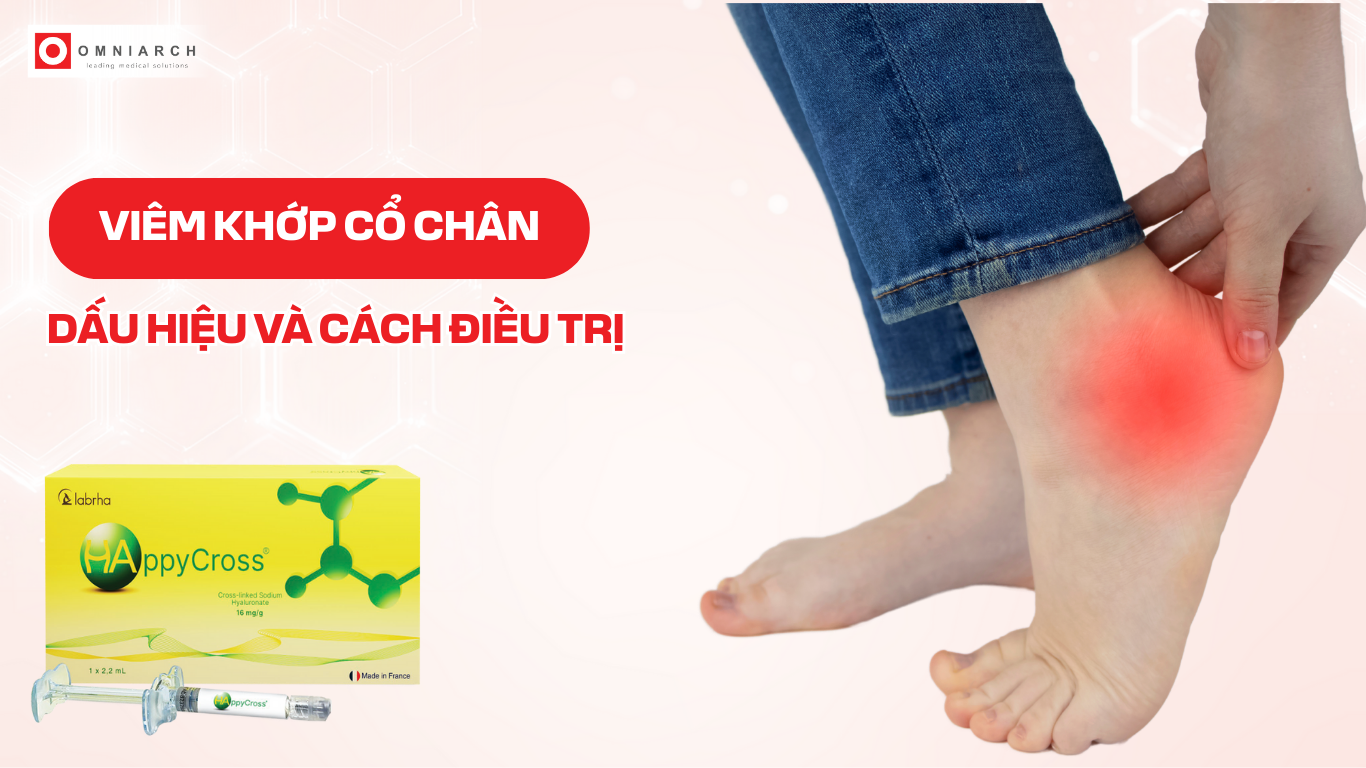 Viêm khớp cổ chân: Dấu hiệu và cách điều trị