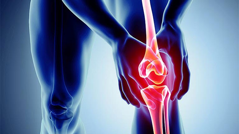 Thoái hóa khớp gối: Nguyên nhân, Triệu chứng &amp; Phương pháp điều trị an toàn