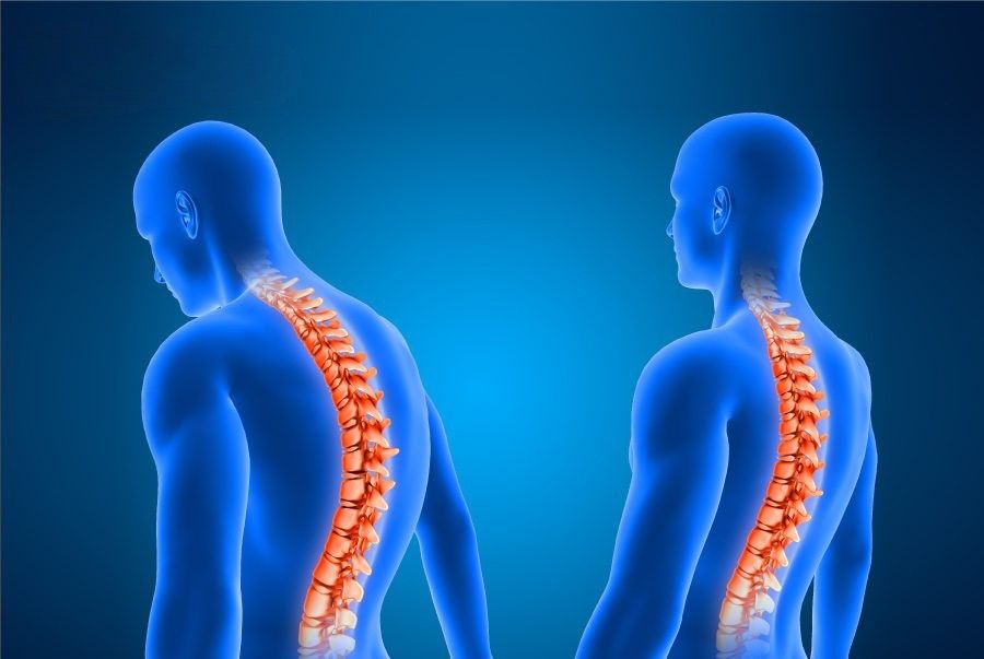 Thoái hóa cột sống: Nguyên nhân, chẩn đoán, phương pháp điều trị