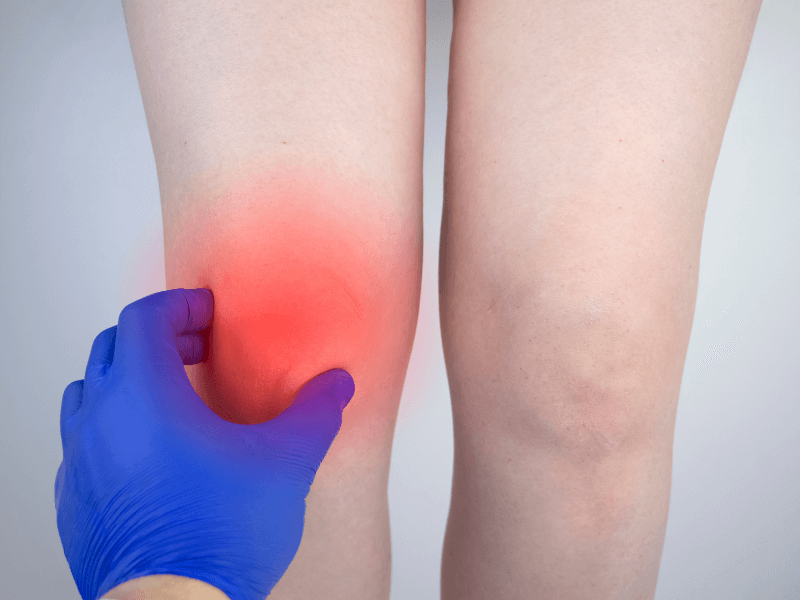  Viêm gân bánh chè: Nguyên nhân, Triệu chứng &amp; Cách chữa trị