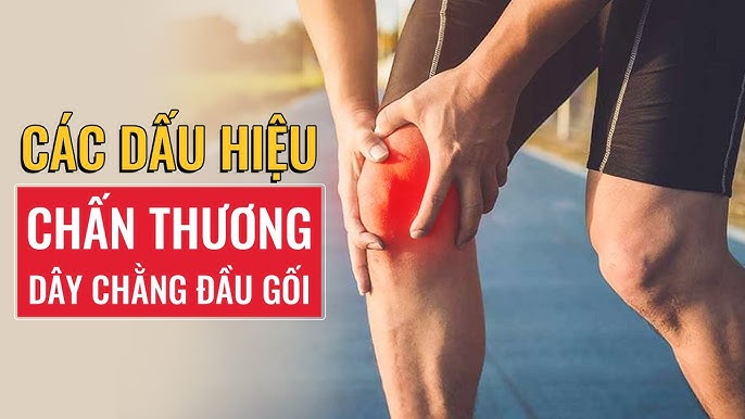 Chấn thương dây chằng đầu gối: Cách nhận biết và điều trị hiệu quả