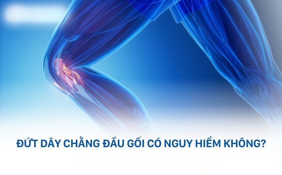 Đứt dây chằng đầu gối có nguy hiểm không?