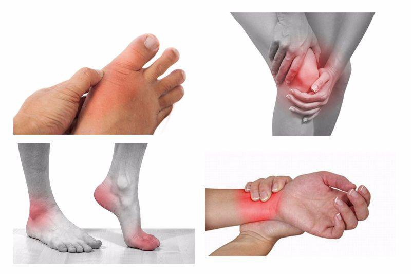 Viêm co rút bao khớp vai: Dấu hiệu, điều trị &amp; cách phòng ngừa