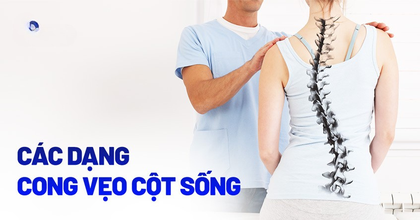 Cong vẹo cột sống có mấy loại và nguyên nhân gây bệnh do đâu?