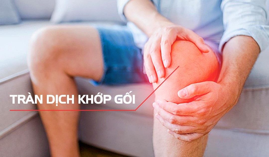 Tràn dịch khớp gối là hiện tượng chất lỏng tích tụ quá nhiều xung quanh và bên trong khớp gối, dẫn đến đau và sưng tấy
