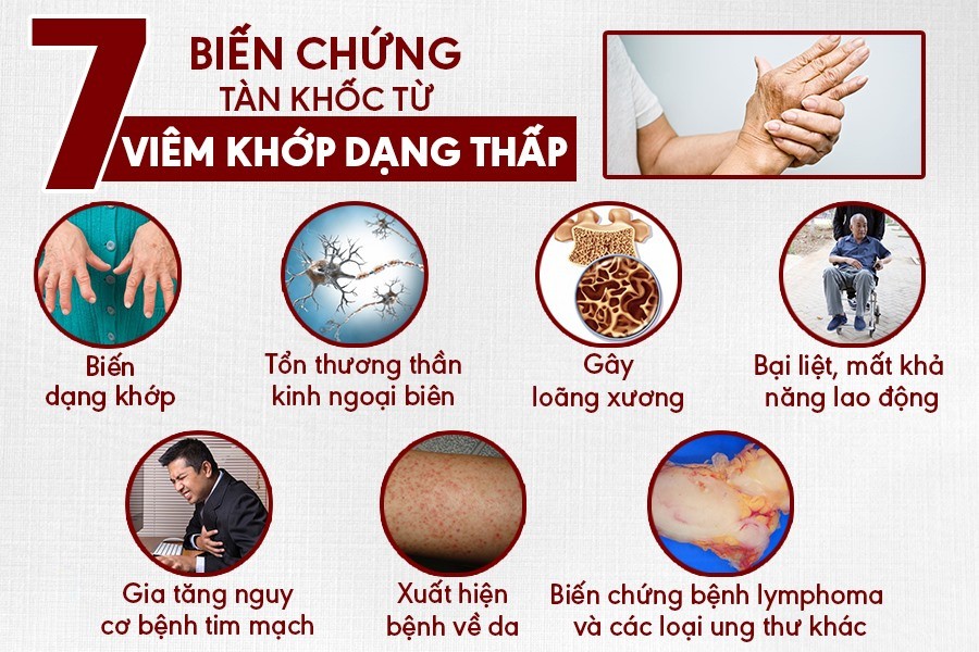 Viêm khớp dạng thấp: Triệu chứng, nguyên nhân và cách phòng ngừa