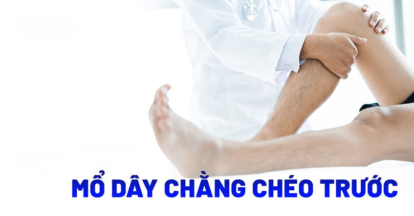 Mổ dây chằng chéo trước bao lâu thì hết sưng