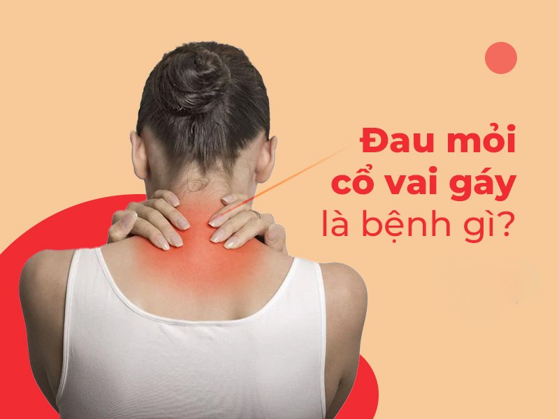 Đau mỏi vai gáy là bệnh gì?