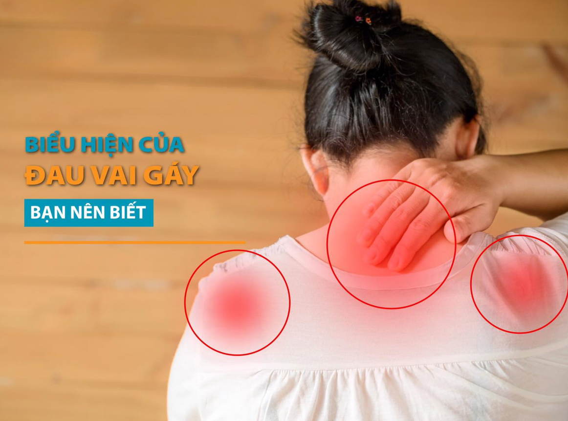 Đau mỏi vai gáy là bệnh gì? Chuyên gia giải đáp trong một nốt nhạc!