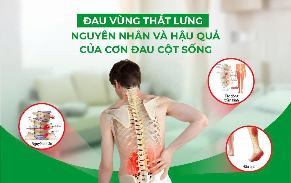 Nguyên nhân đau vùng thắt lưng
