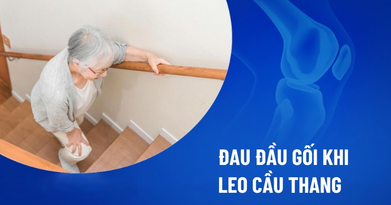 Nguyên nhân đau đầu gối khi lên xuống cầu thang