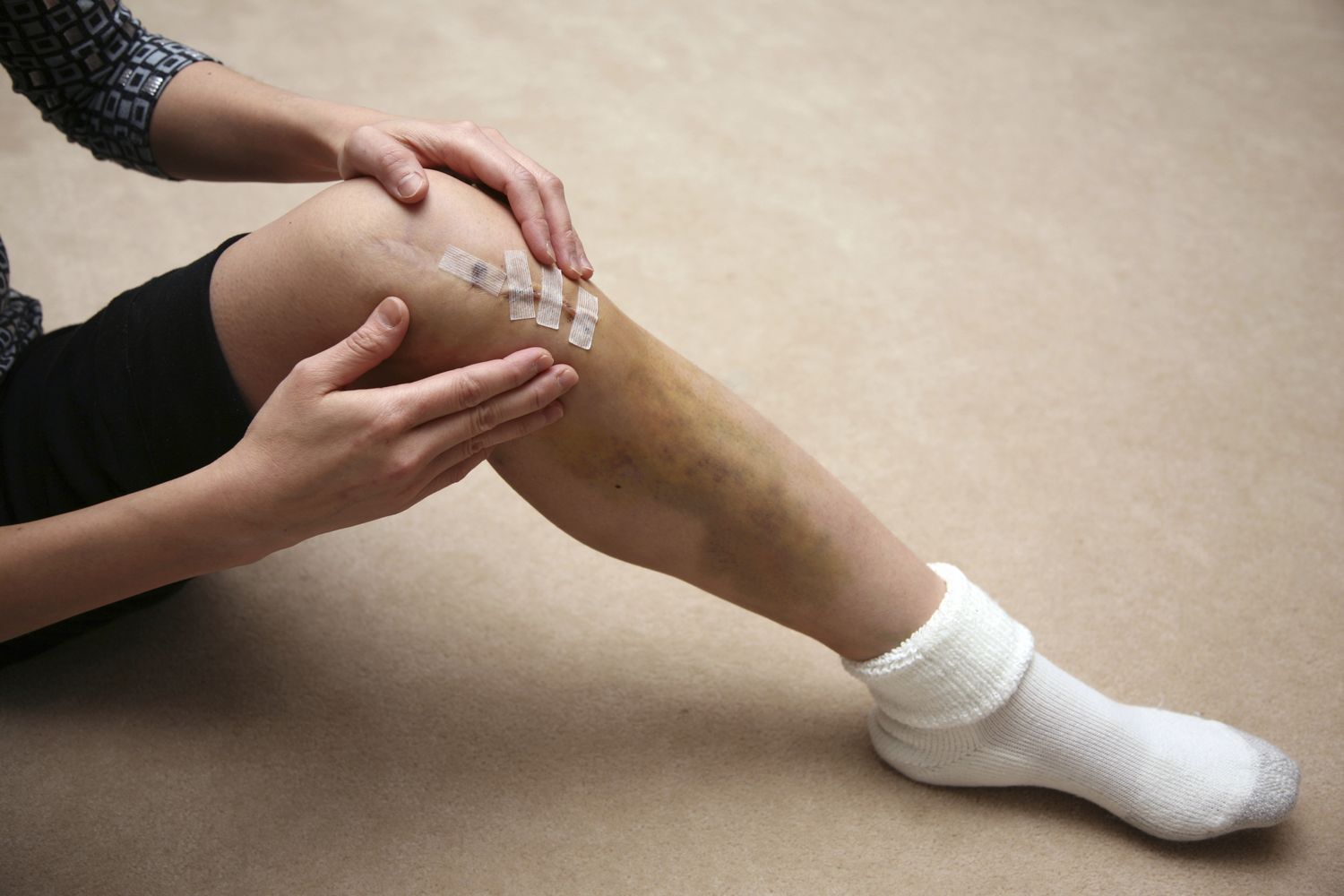 Cách khắc phục tình trạng lỏng gối sau mổ dây chằng chéo trước