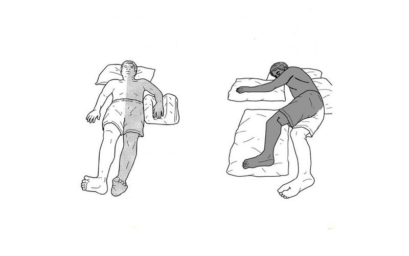 Chủ quan với thoát vị đĩa đệm cột sống cổ, coi chừng “rước họa vào thân”