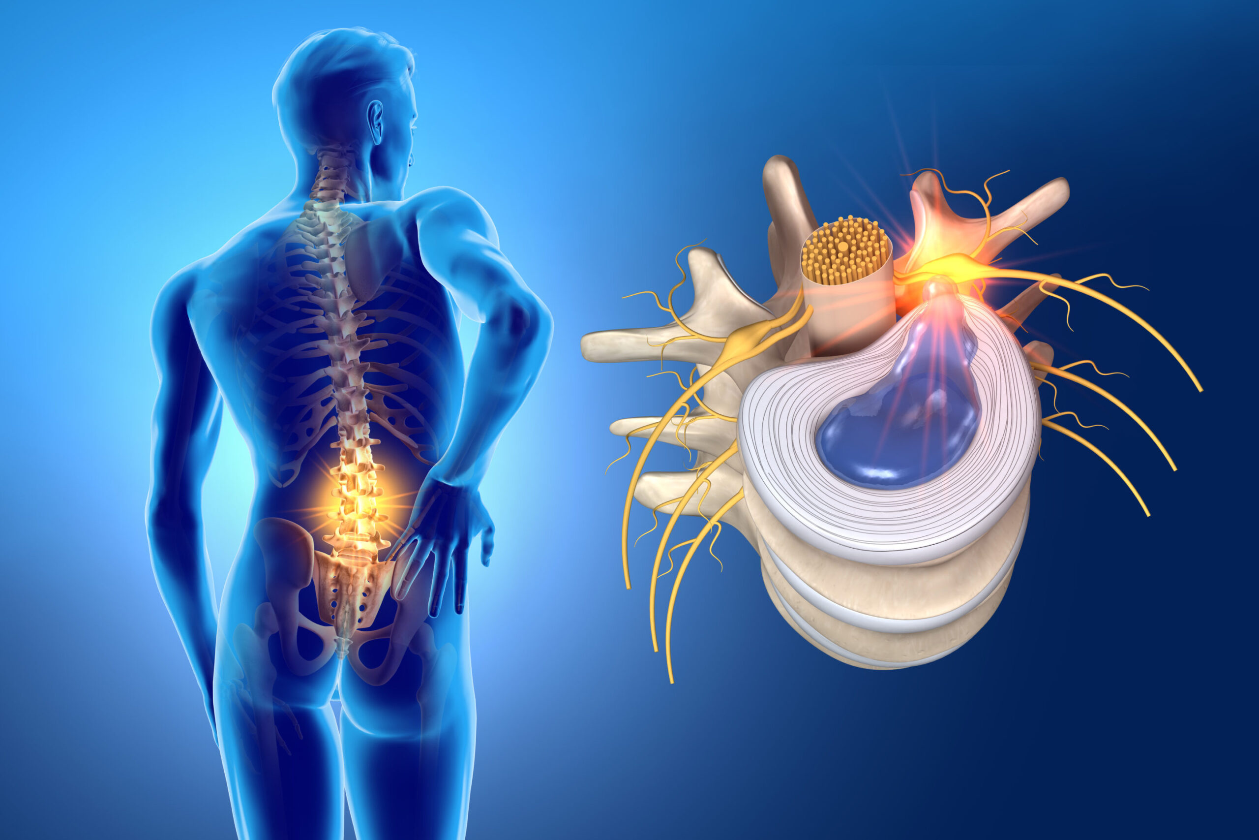 Tê chân sau mổ thoát vị đĩa đệm do tổn thương thần kinh