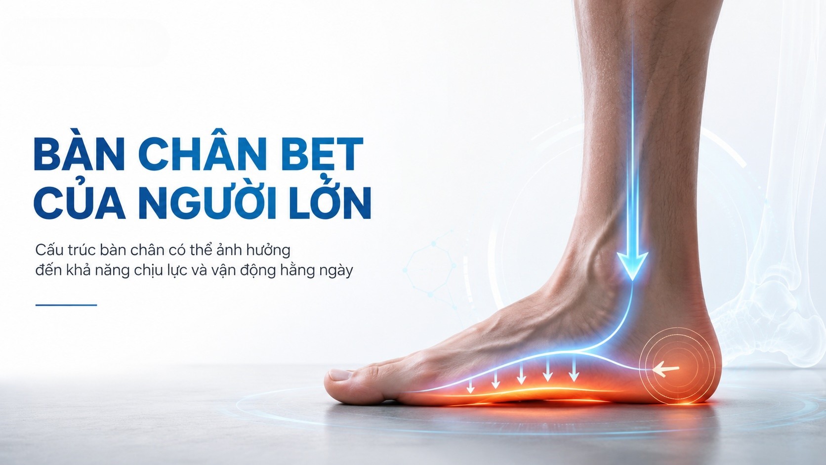 Bàn chân bẹt ở người lớn là gì?